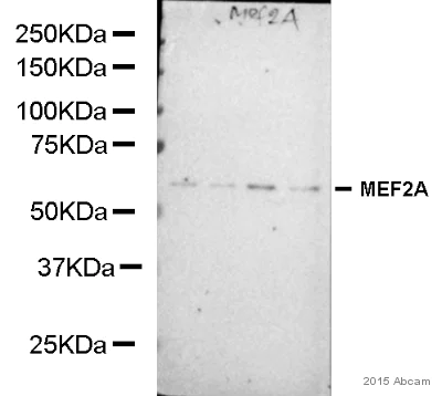 Western blot - Anti-MEF2A antibody [EP1706Y] (AB76063)
