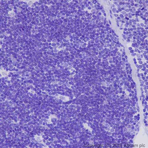 Immunohistochemistry (Formalin/PFA-fixed paraffin-embedded sections) - Anti-MEF2A + MEF2C antibody [EPR19089-34] (ab197070), expandable thumbnail