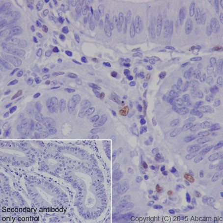 Immunohistochemistry (Formalin/PFA-fixed paraffin-embedded sections) - Anti-MEF2A + MEF2C antibody [EPR19089-34] (ab197070), expandable thumbnail