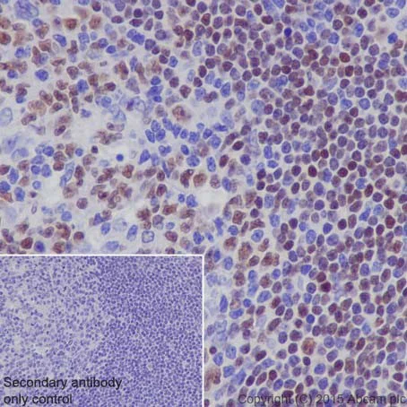 Immunohistochemistry (Formalin/PFA-fixed paraffin-embedded sections) - Anti-MEF2A + MEF2C antibody [EPR19089-34] (AB197070)