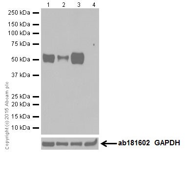 Western blot - Anti-MEF2A + MEF2C antibody [EPR19089-34] (AB197070), expandable thumbnail