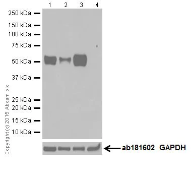 Western blot - Anti-MEF2A + MEF2C antibody [EPR19089-34] (AB197070)