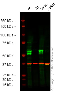 Western blot - Anti-MEF2A + MEF2C antibody [EPR19089-34] (AB197070)