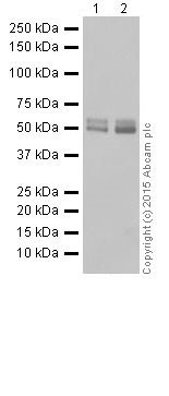 Western blot - Anti-MEF2A + MEF2C antibody [EPR19089-34] (AB197070), expandable thumbnail