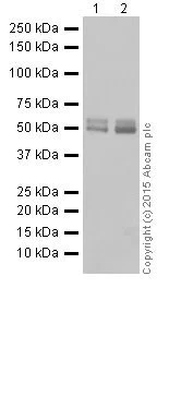 Western blot - Anti-MEF2A + MEF2C antibody [EPR19089-34] (AB197070)