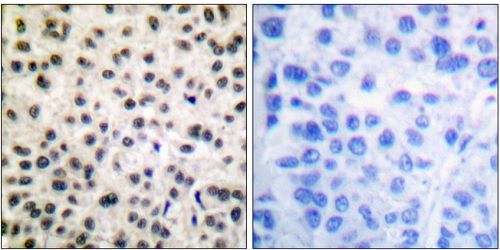 Immunohistochemistry (Formalin/PFA-fixed paraffin-embedded sections) - Anti-MEF2A (phospho S408) antibody (AB51151)