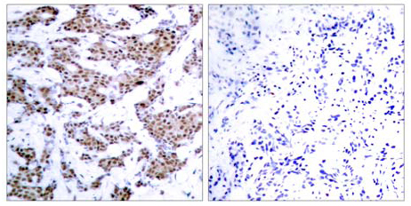 Immunohistochemistry (Formalin/PFA-fixed paraffin-embedded sections) - Anti-MEF2A (phospho T312) antibody (AB30644), expandable thumbnail