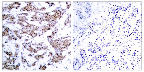 Immunohistochemistry (Formalin/PFA-fixed paraffin-embedded sections) - Anti-MEF2A (phospho T312) antibody (AB30644)