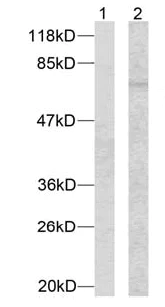 Western blot - Anti-MEF2A (phospho T312) antibody (AB30644)