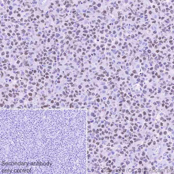 Immunohistochemistry (Formalin/PFA-fixed paraffin-embedded sections) - Anti-MEF2B antibody [EPR22193-26] (AB242058)