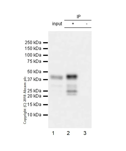 Immunoprecipitation - Anti-MEF2B antibody [EPR22193-26] (AB242058)