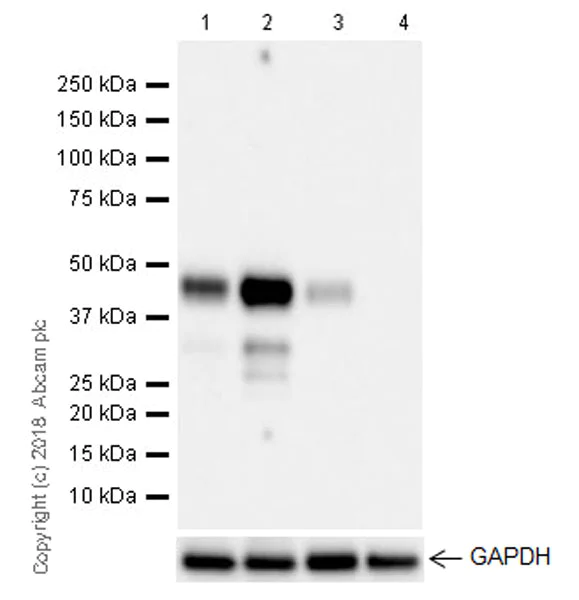Western blot - Anti-MEF2B antibody [EPR22193-26] (AB242058)