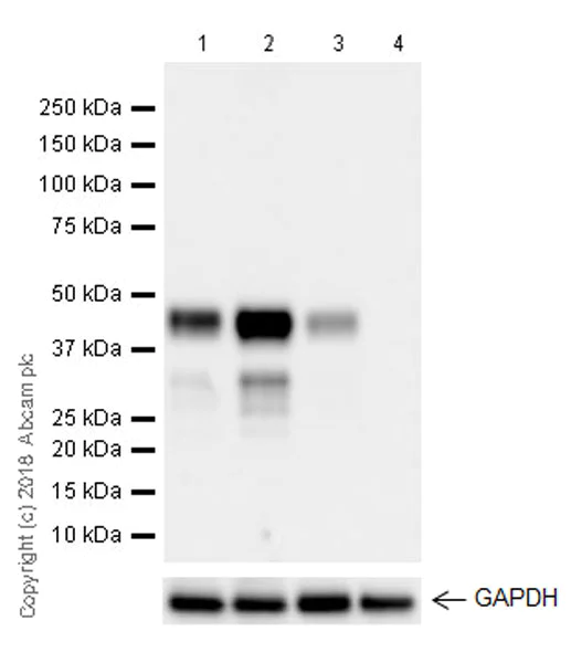 Western blot - Anti-MEF2B antibody [EPR22193-78] (AB242059)