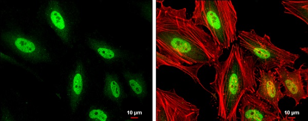 Immunocytochemistry/ Immunofluorescence - Anti-MEF2C antibody (AB227085)