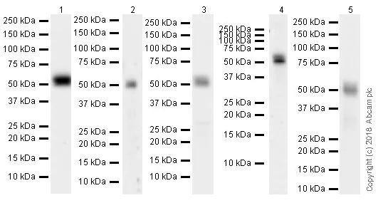 Western blot - Anti-MEF2C antibody [EPR19089-202] - ChIP Grade (AB211493)