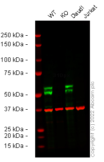 Western blot - Anti-MEF2C antibody [EPR19089-202] - ChIP Grade (ab211493), expandable thumbnail