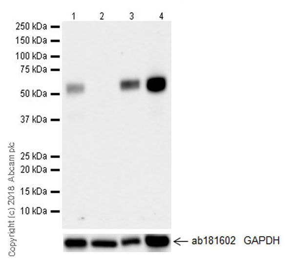 Western blot - Anti-MEF2C antibody [EPR19089-202] - ChIP Grade (AB211493), expandable thumbnail