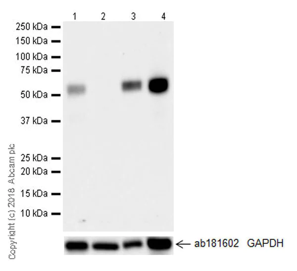 Western blot - Anti-MEF2C antibody [EPR19089-202] - ChIP Grade (AB211493)