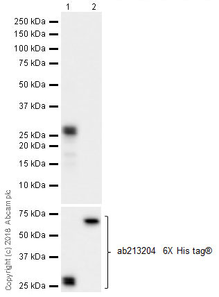 Western blot - Anti-MEF2C antibody [EPR19089-202] - ChIP Grade (AB211493), expandable thumbnail