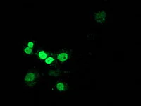 Immunocytochemistry/ Immunofluorescence - Anti-MEF2C antibody [OTI4B10] (AB118406)