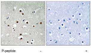 Immunohistochemistry (Formalin/PFA-fixed paraffin-embedded sections) - Anti-MEF2C (phospho S396) antibody (AB78888)