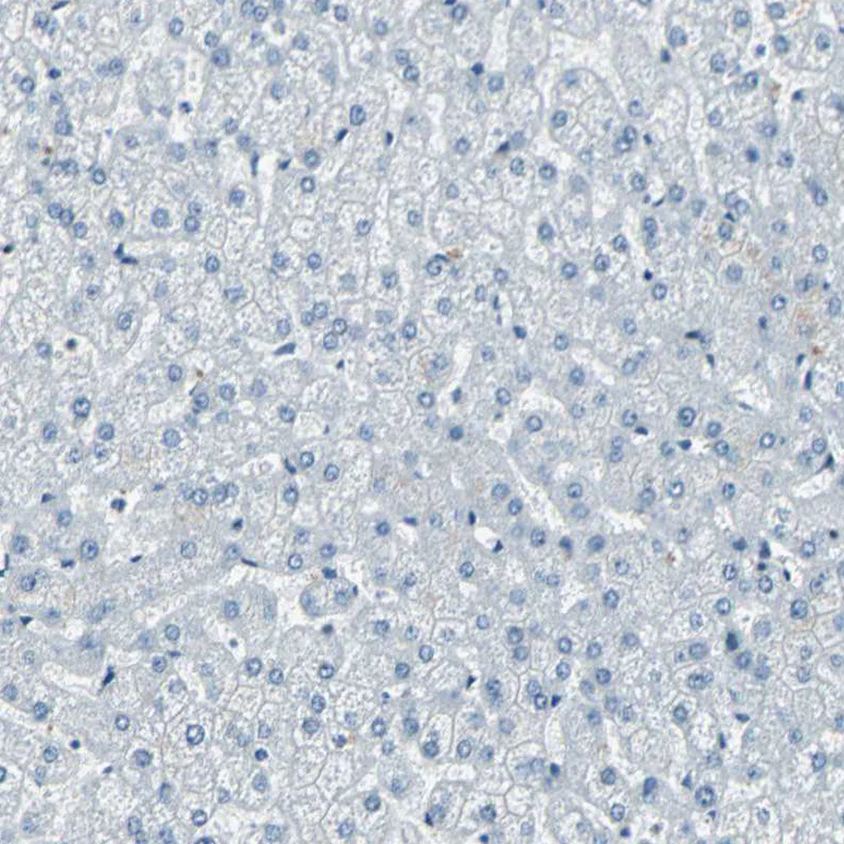 Immunohistochemistry (Formalin/PFA-fixed paraffin-embedded sections) - Anti-MEF2D antibody (AB246884)