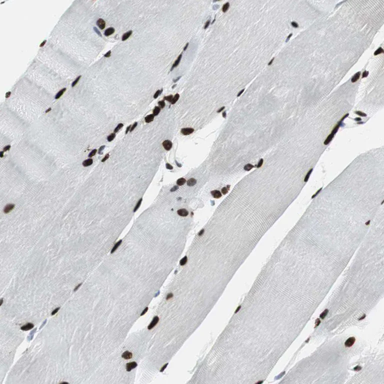Immunohistochemistry (Formalin/PFA-fixed paraffin-embedded sections) - Anti-MEF2D antibody (AB246884)