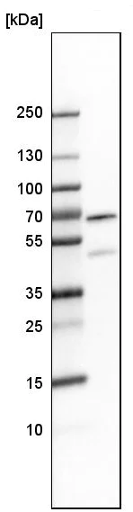 Western blot - Anti-MEF2D antibody (AB246884)