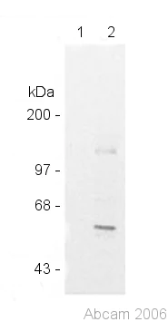 Immunoprecipitation - Anti-MEF2D antibody (AB32845)