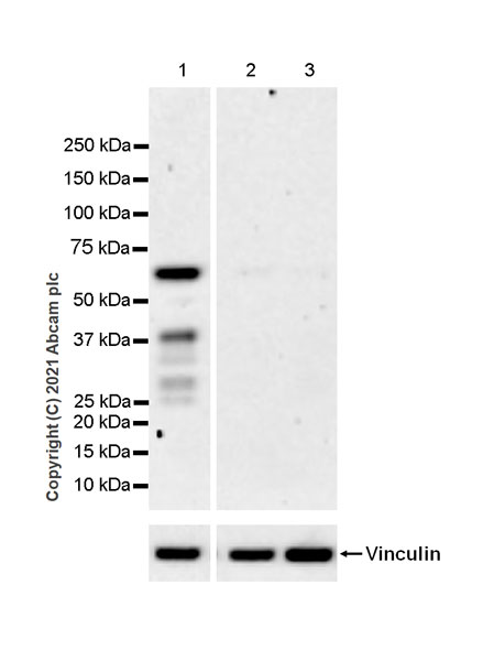 Western blot - Anti-MEF2D antibody [EPR24993-10] (AB282731), expandable thumbnail