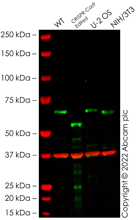 Western blot - Anti-MEF2D antibody [EPR24993-10] (ab282731), expandable thumbnail