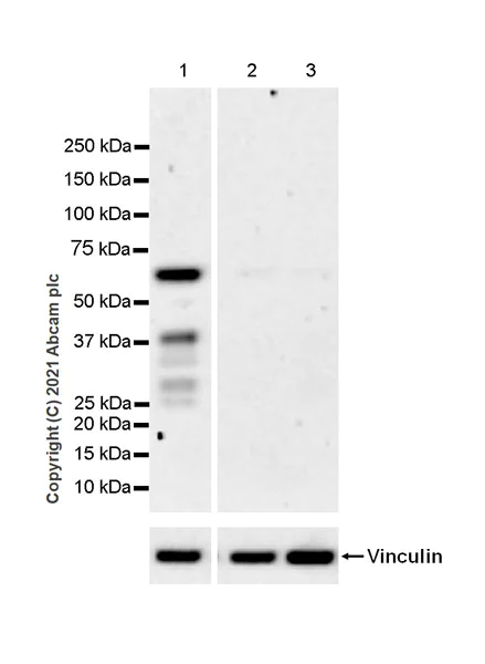 Western blot - Anti-MEF2D antibody [EPR24993-10] - BSA and Azide free (AB282733)