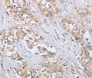 Immunohistochemistry (Formalin/PFA-fixed paraffin-embedded sections) - Anti-MEG1 antibody - N-terminal (AB200363)