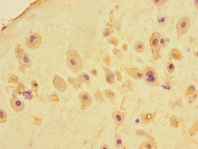 Immunohistochemistry (Formalin/PFA-fixed paraffin-embedded sections) - Anti-Meikin antibody (AB234661), expandable thumbnail