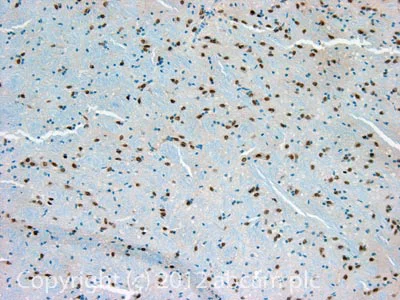 Immunohistochemistry (Formalin/PFA-fixed paraffin-embedded sections) - Anti-MEIS1 antibody (AB19867)