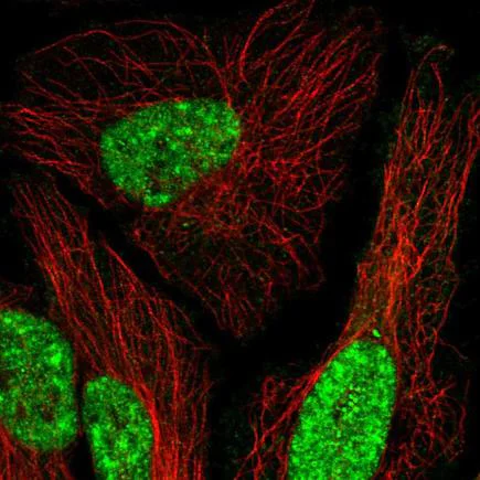Immunocytochemistry/ Immunofluorescence - Anti-MEIS1 antibody (AB222246)