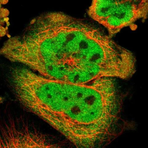 Immunocytochemistry/ Immunofluorescence - Anti-MEIS2 antibody (AB244267)