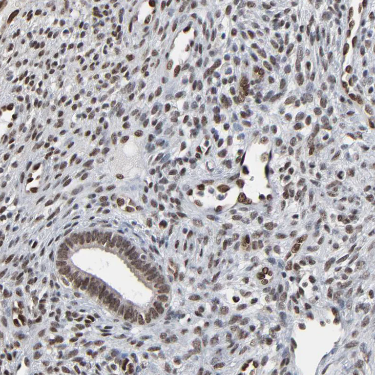 Immunohistochemistry (Formalin/PFA-fixed paraffin-embedded sections) - Anti-MEIS2 antibody (AB244267)