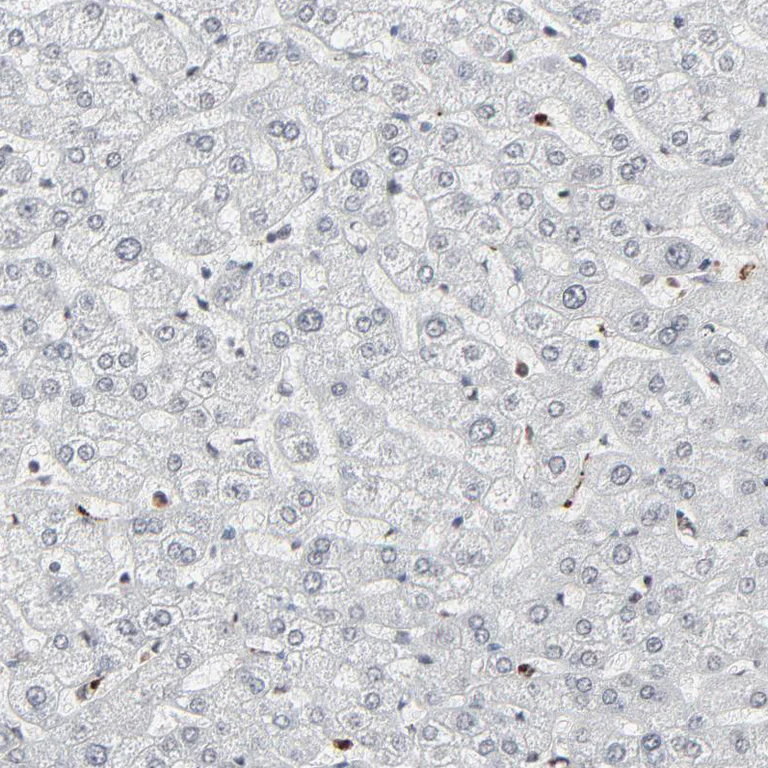 Immunohistochemistry (Formalin/PFA-fixed paraffin-embedded sections) - Anti-MEIS2 antibody (AB244267)