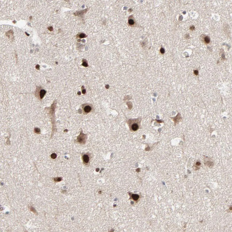 Immunohistochemistry (Formalin/PFA-fixed paraffin-embedded sections) - Anti-MEIS2 antibody (AB244267)