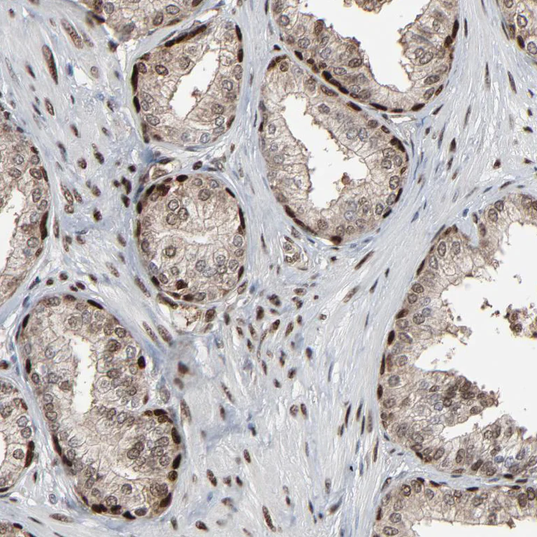 Immunohistochemistry (Formalin/PFA-fixed paraffin-embedded sections) - Anti-MEIS2 antibody (AB244267)