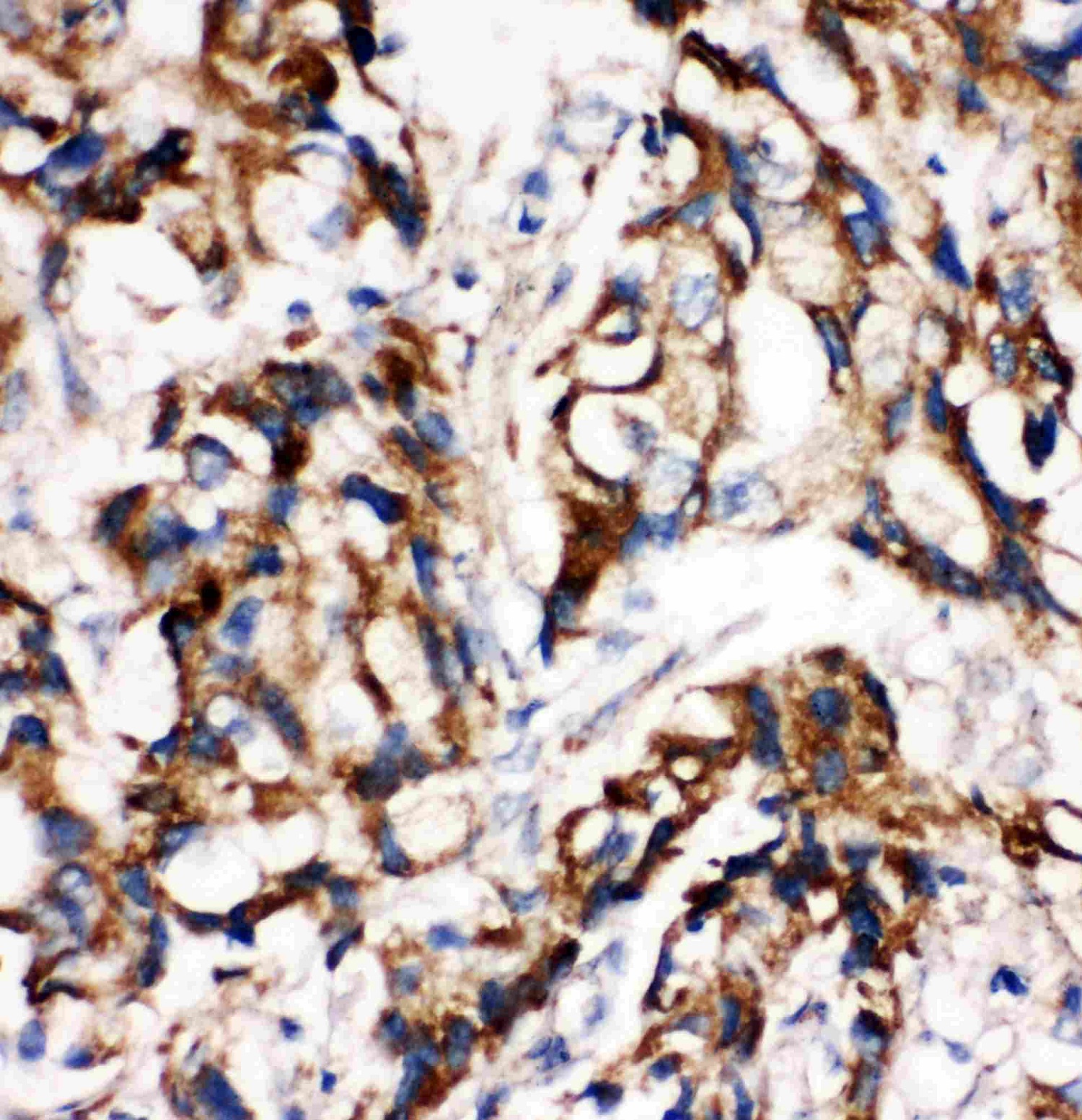 Immunohistochemistry (Formalin/PFA-fixed paraffin-embedded sections) - Anti-MEK1 antibody (AB109556)