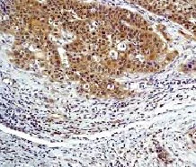 Immunohistochemistry (Formalin/PFA-fixed paraffin-embedded sections) - Anti-MEK1 antibody [E342] (AB32091)