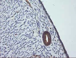 Immunohistochemistry (Formalin/PFA-fixed paraffin-embedded sections) - Anti-MEK1 antibody [OTI4E1] (AB139343)