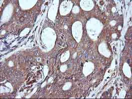 Immunohistochemistry (Formalin/PFA-fixed paraffin-embedded sections) - Anti-MEK1 antibody [OTI4E1] (AB139343)
