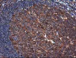 Immunohistochemistry (Formalin/PFA-fixed paraffin-embedded sections) - Anti-MEK1 antibody [OTI4E1] (AB139343)