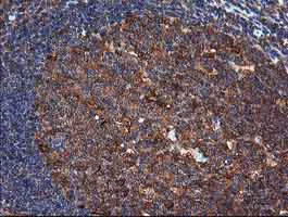 Immunohistochemistry (Formalin/PFA-fixed paraffin-embedded sections) - Anti-MEK1 antibody [OTI4E1] (AB139343)