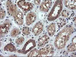 Immunohistochemistry (Formalin/PFA-fixed paraffin-embedded sections) - Anti-MEK1 antibody [OTI4E1] (AB139343)