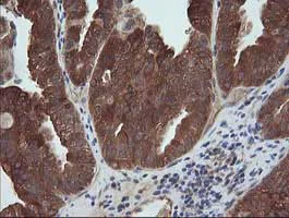 Immunohistochemistry (Formalin/PFA-fixed paraffin-embedded sections) - Anti-MEK1 antibody [OTI4E1] (AB139343)