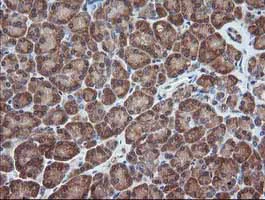 Immunohistochemistry (Formalin/PFA-fixed paraffin-embedded sections) - Anti-MEK1 antibody [OTI4E1] (AB139343)